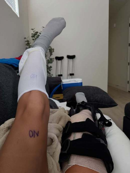 湖人半决赛对阵雷霆 杰林女友晒照回顾ACL康复历